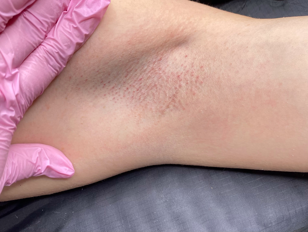 UNDERARM WAX