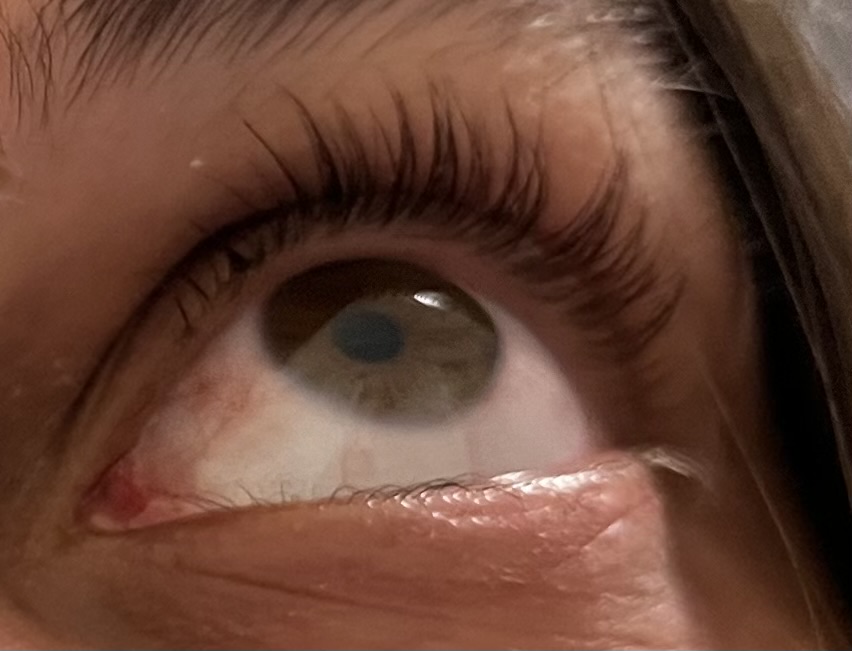 Lash Lift