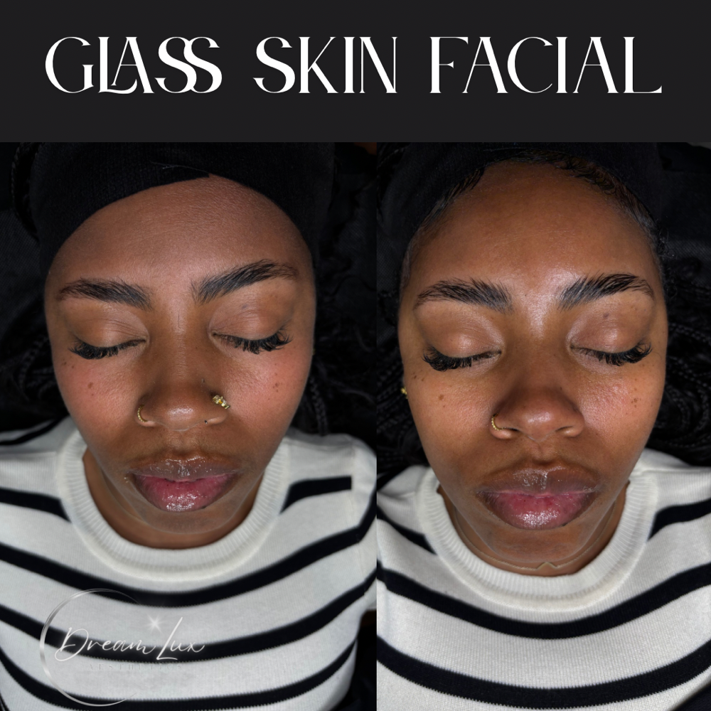 DreamSkin: Glass Skin