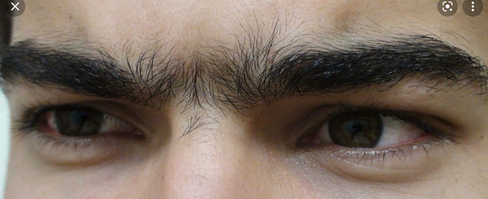 Uni Brow