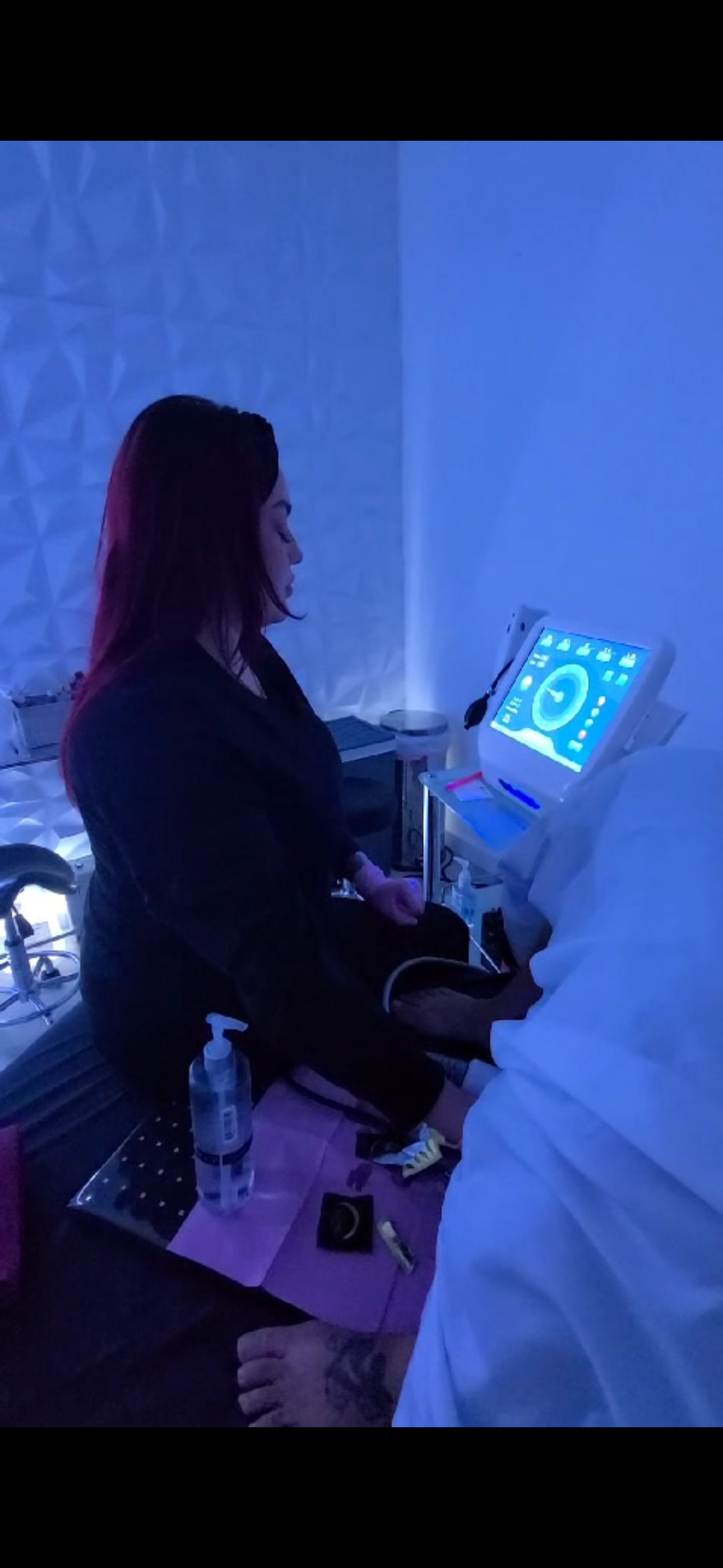 HIFU Intimate Rejuvenation