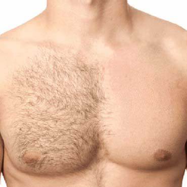 Chest Wax