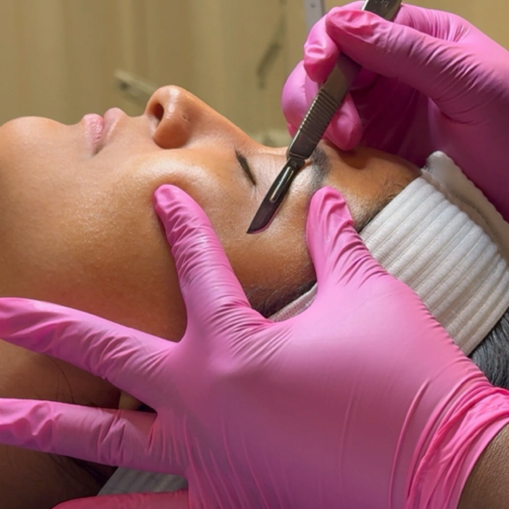 Dermaplane at The Beauty Santuary in Twentynine Palms, CA