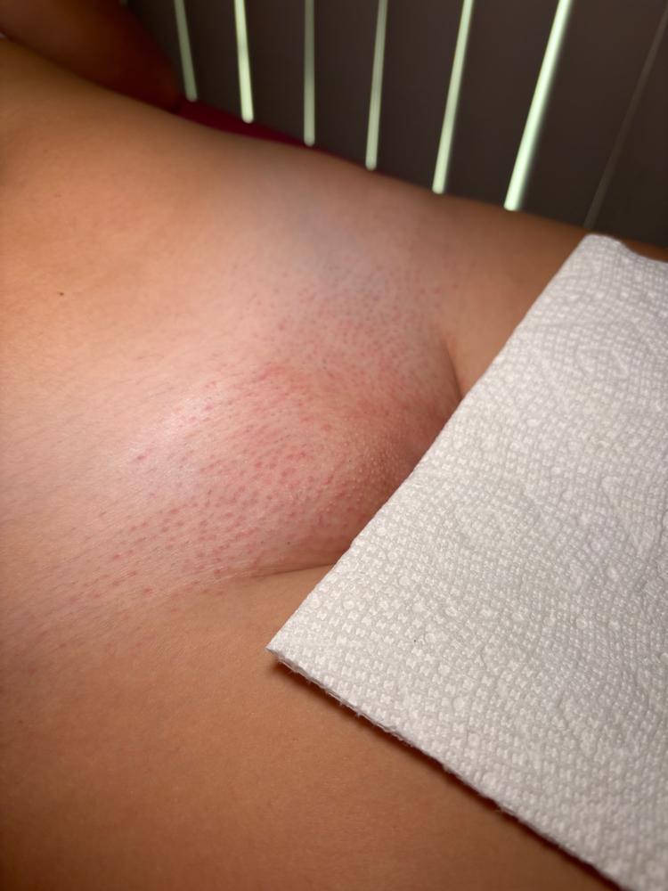 Brazilian Wax