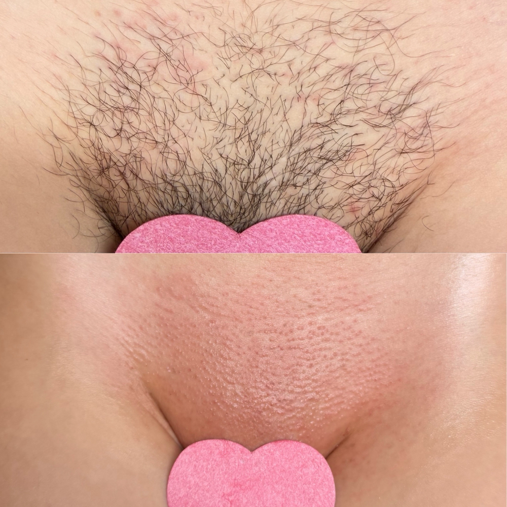 Brazilian at Magnolia Skin Studio in Fruitland, ID