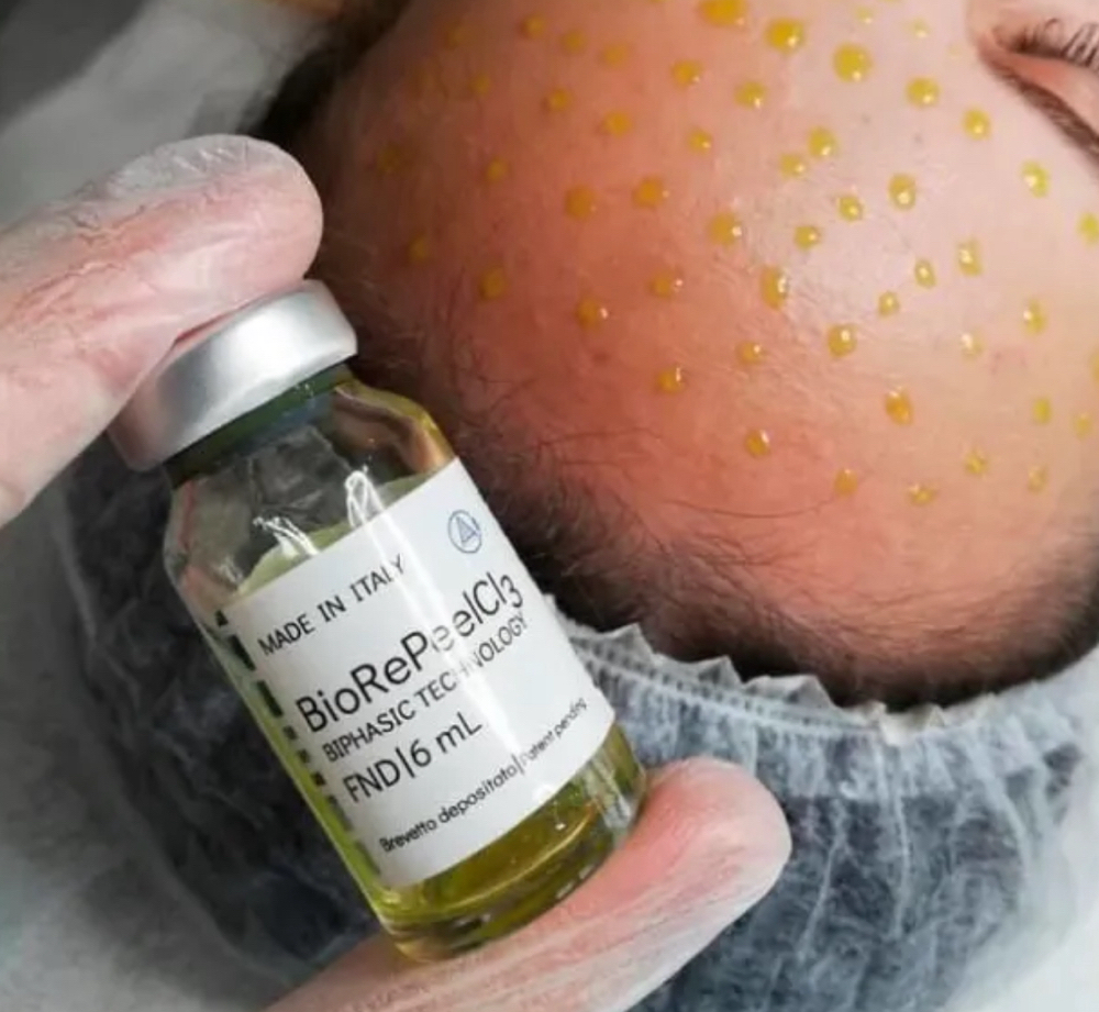 BioRePeel Skin Renewal Treatment