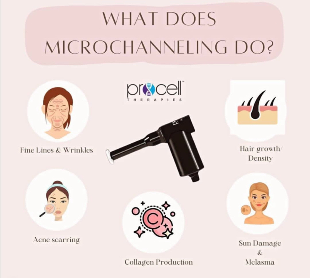 Procell Microchanneling