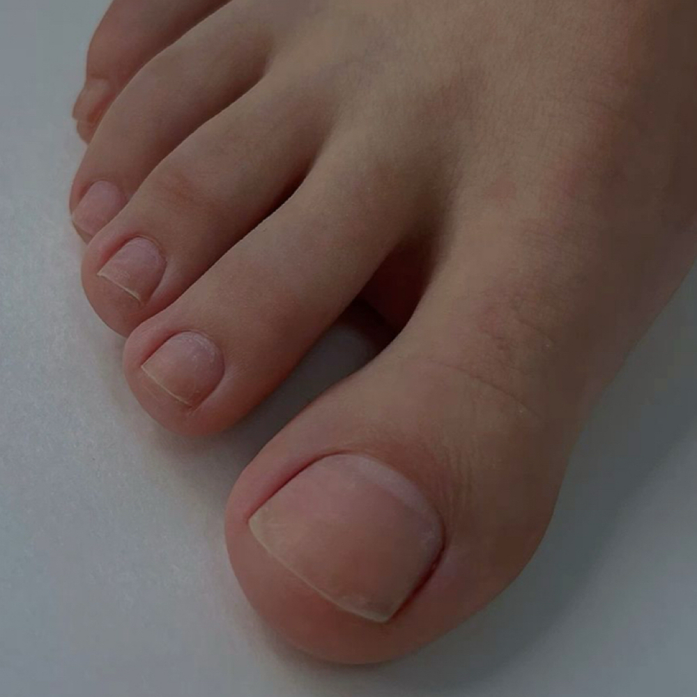 Toe Nail Fix at Polished by Precious in Knoxville, TN