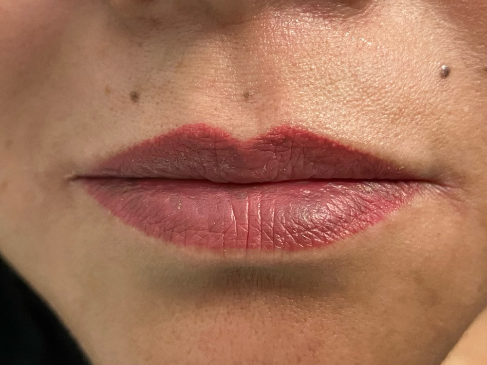 Consultation For LipPermanentMakeup