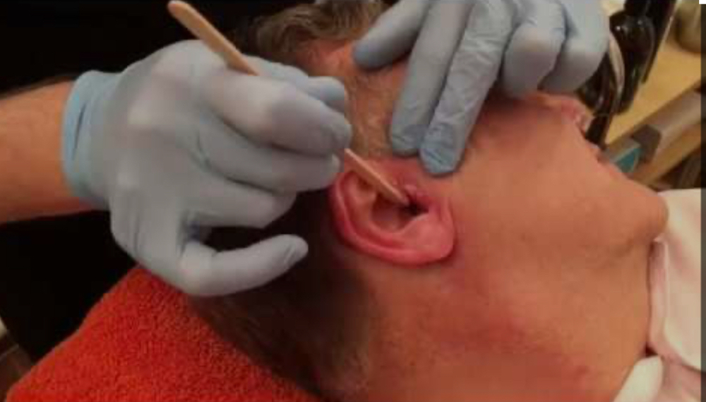 Ear Wax