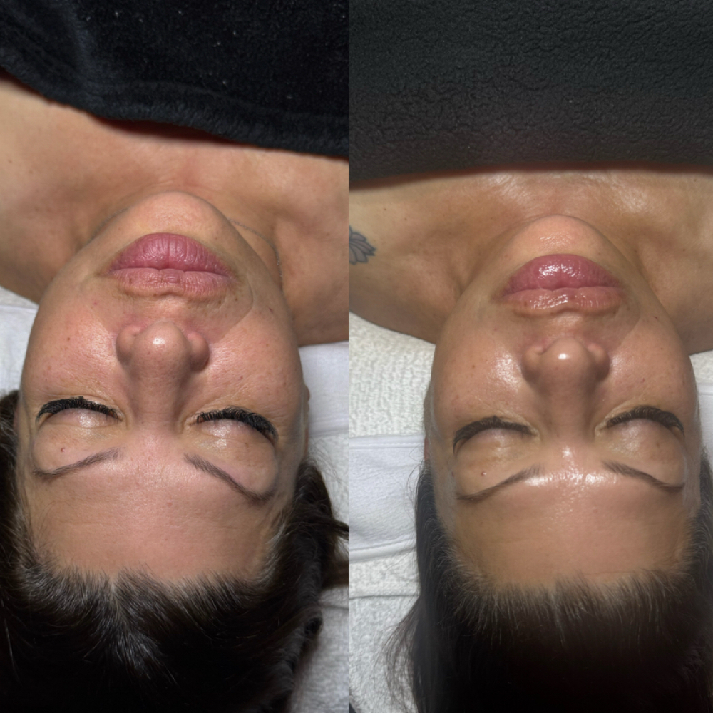 Age Defy Facial at Esthetics By KS in Ontario, CA