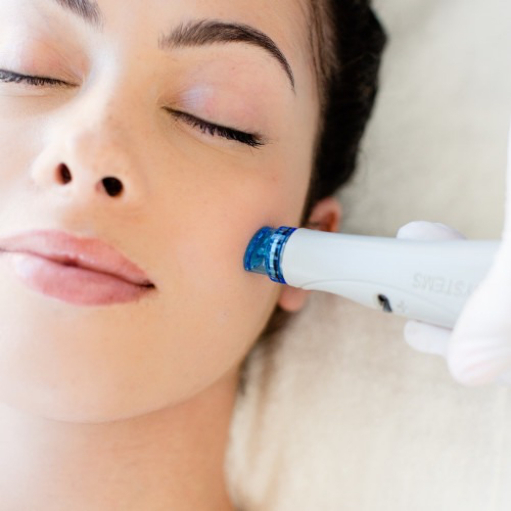 Hydradermabrasion & Oxygen Facial at Bayou Glow, LLC in Larose, LA