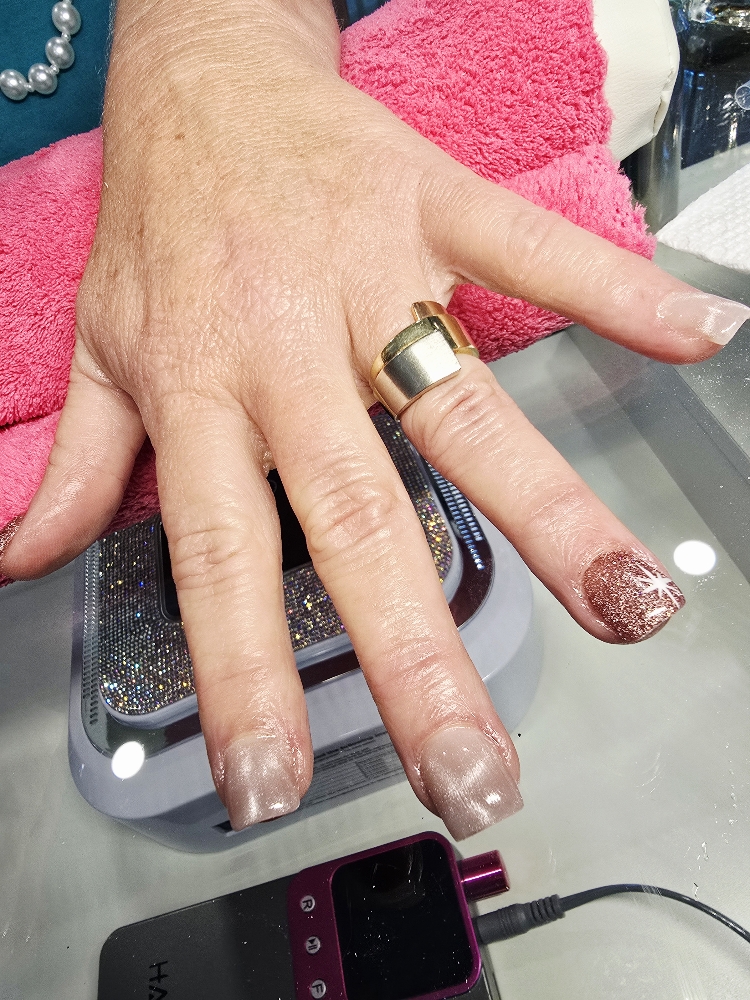Gel Overlay Removal