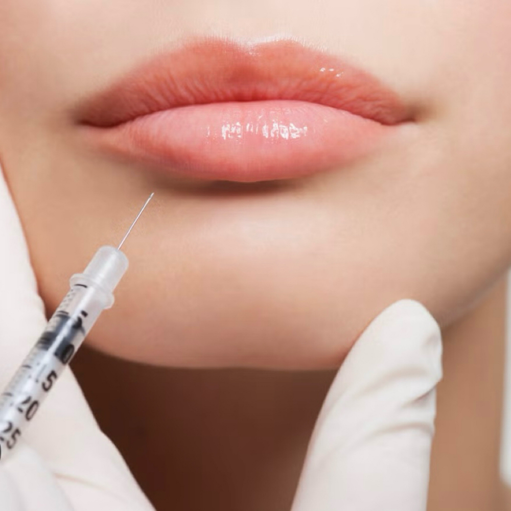 Mini Plump + Lip Flip at Grace Infused Wellness & Aesthetics in Broken Bow, OK