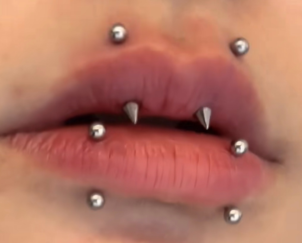 Paired Vertical Upper Lip Piercings