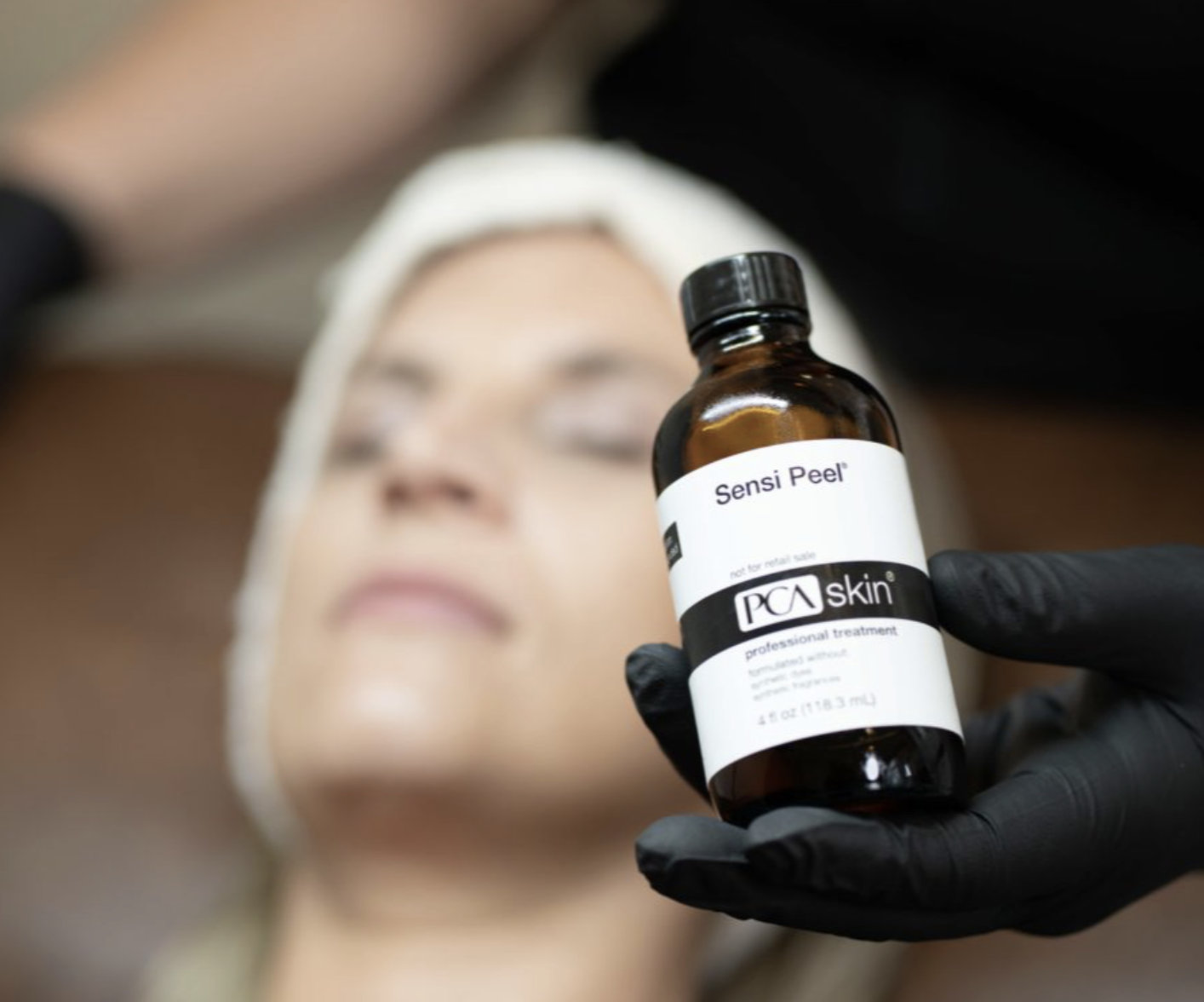 Chemical peel