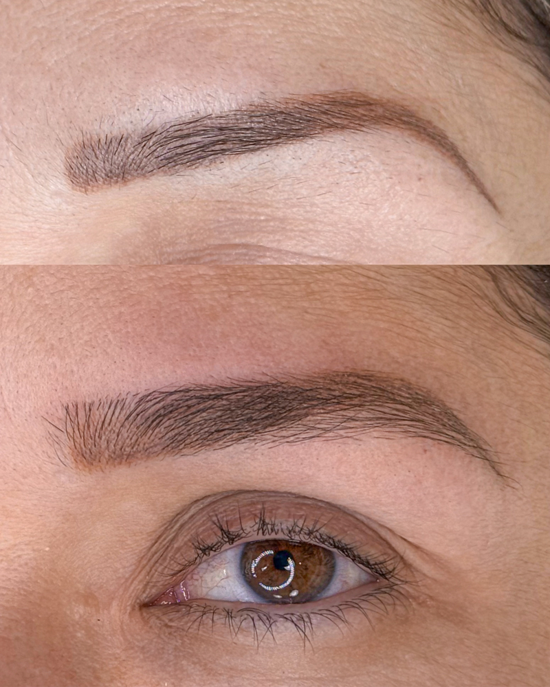 Brow Reconstruction Therapy