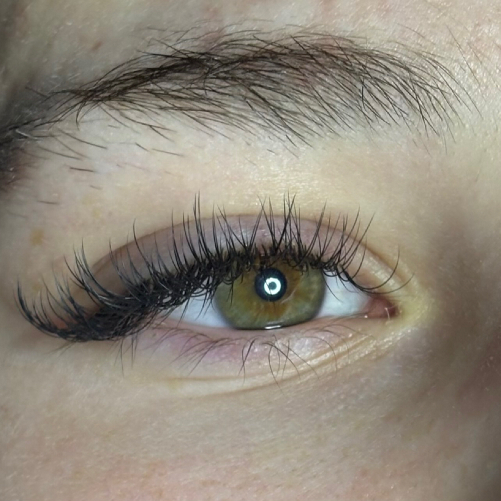 Fill: 2-week Classic at S.T. Esthetics in Michigan City, IN