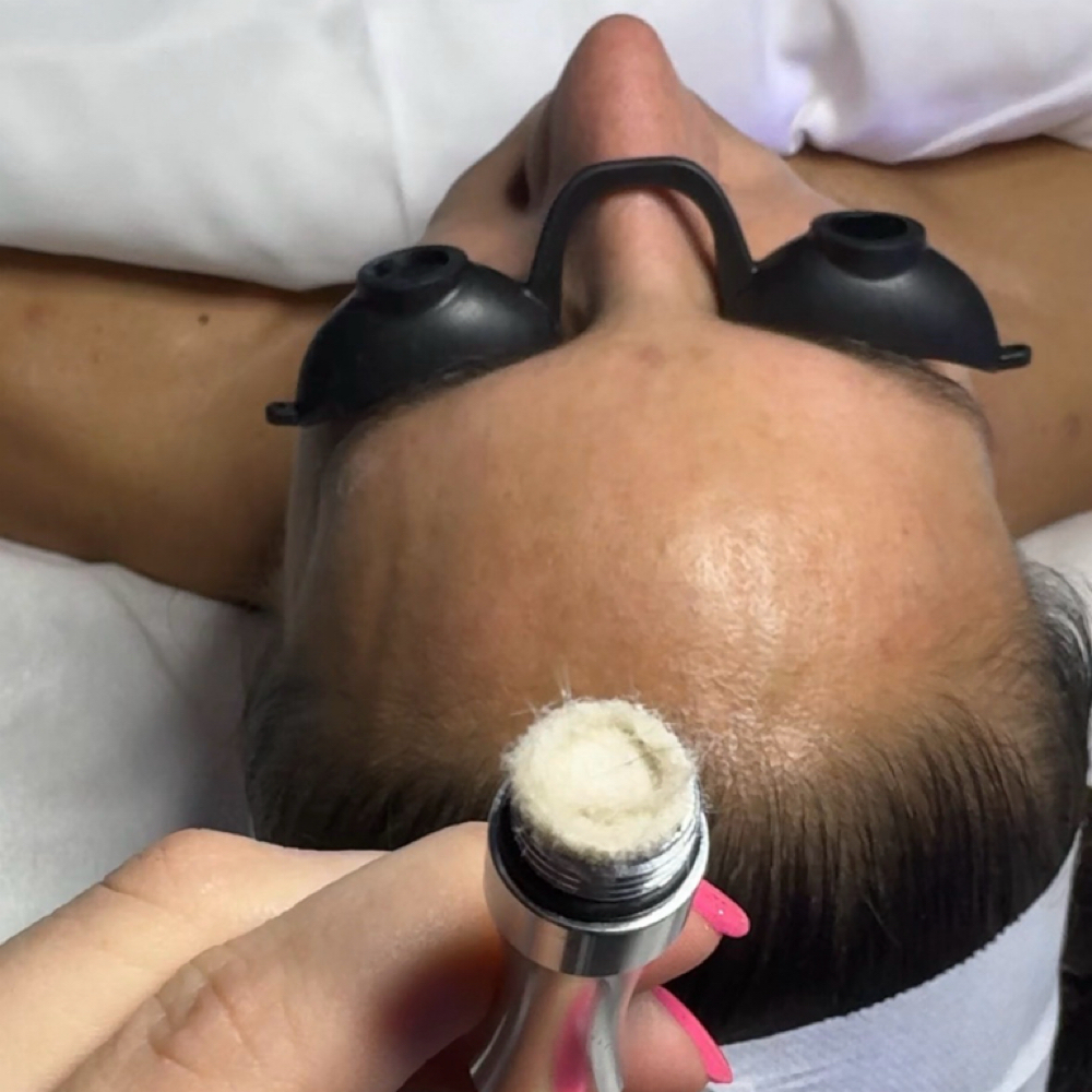 Microdermabrasion Facial at Skinfinity & Beyond in Davidson, NC