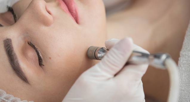 Microdermabrasion Facial