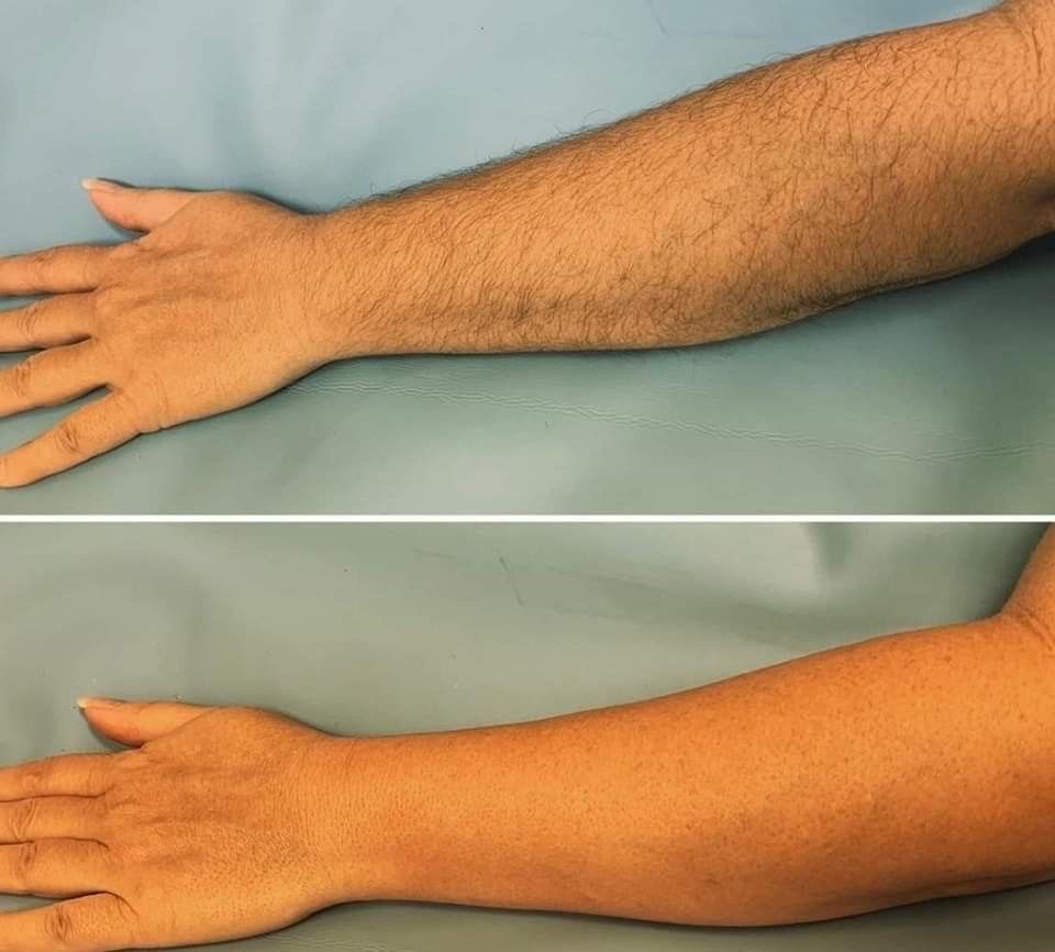 Arm Wax
