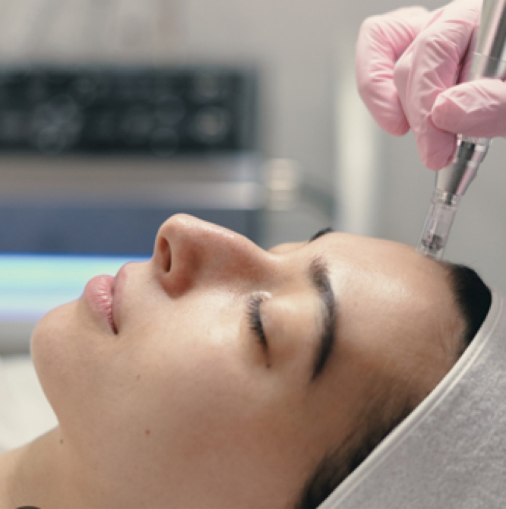 Nano Infusion + Dermaplaning at Blonde Blow Dry & Brow Salon in Yuma, AZ