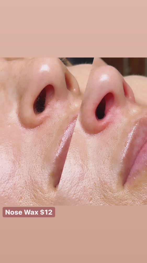 Nose