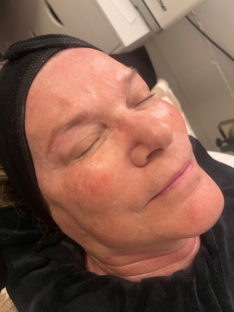 Hydrating Facial