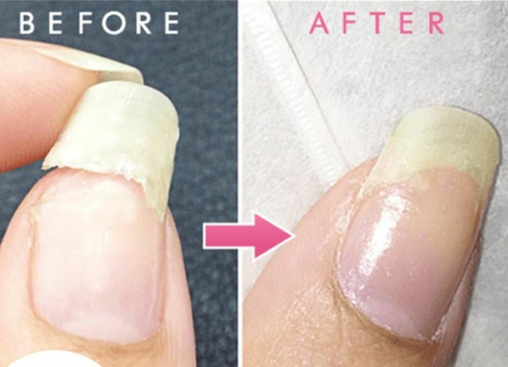 Nail Repair/Hands/Each