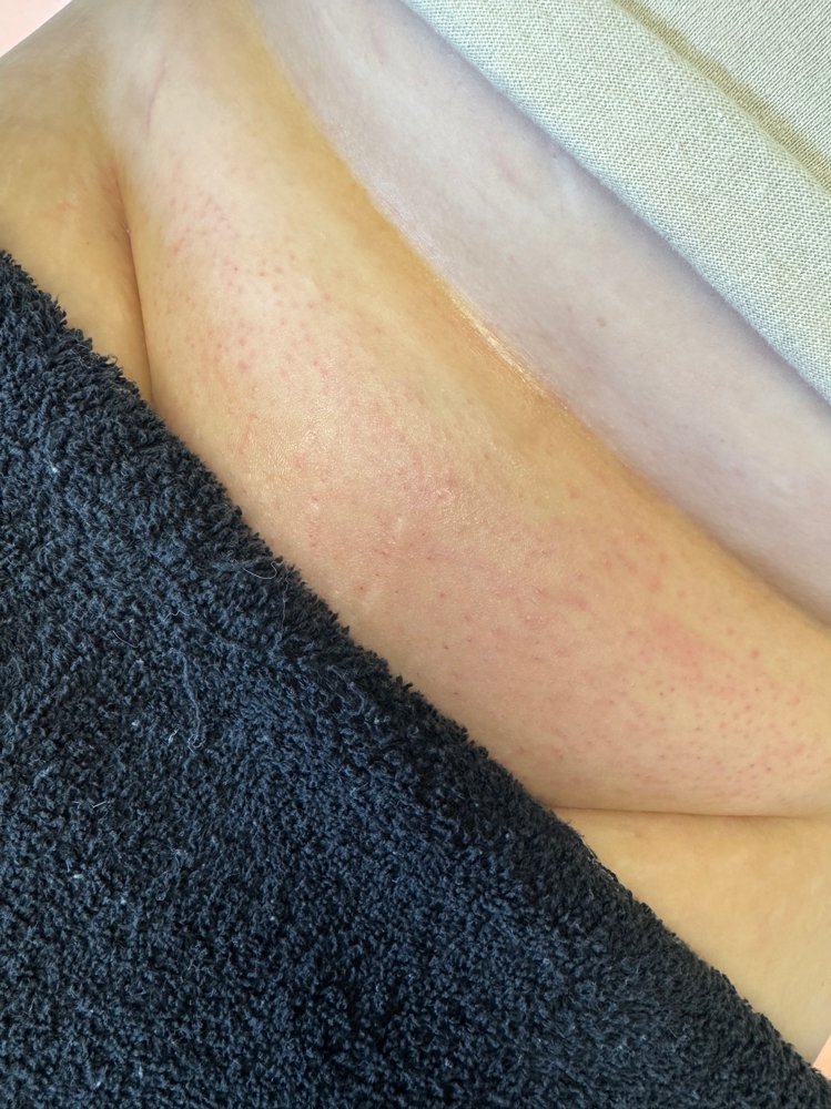 Brazilian Wax