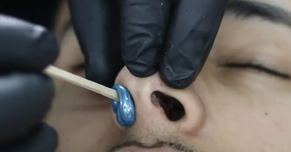 Nose Hair Removal