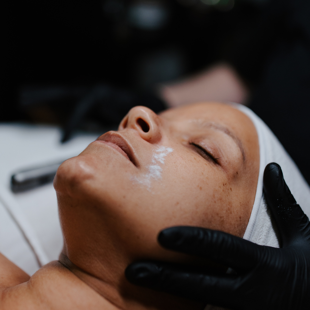 v-lift facial