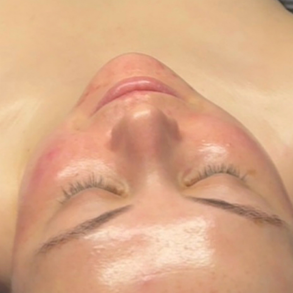 Renewal 3 Facial at VANSTONE in Jonesboro, AR