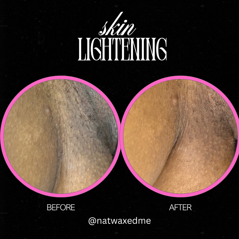 Intimate Lightening