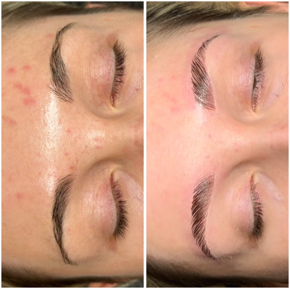Brow Lamination