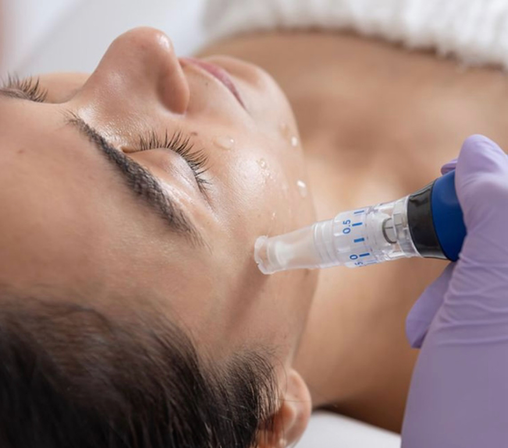 SkinPen Microneedling at Skin By Ragan in Columbus, MS