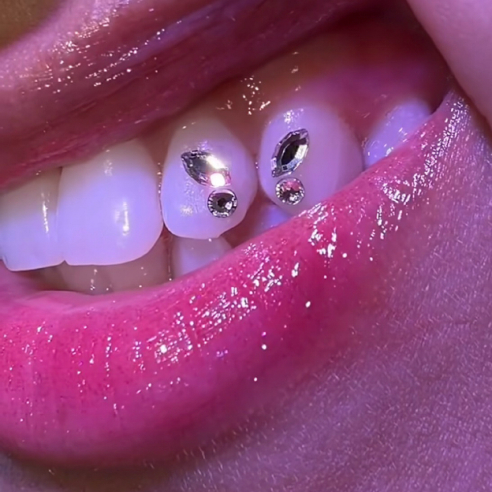 Tooth Gem Application Butterfly at Icey Whites By Blondee in Lawrence, MA
