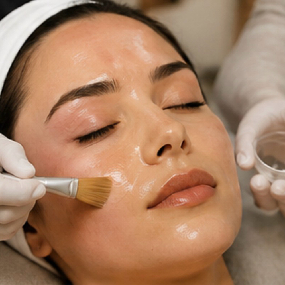Chemical Peel (With Aftercare Kit) at MS Beauty Studio NY in Staten Island, NY