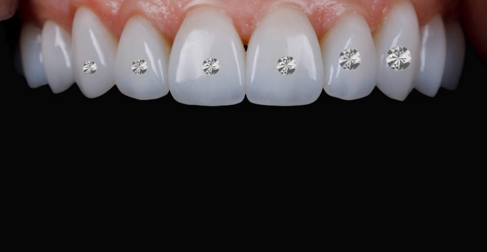 Swarovski Tooth Crystal-Single