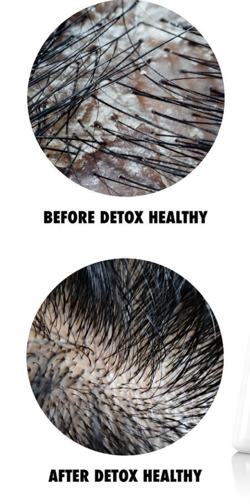 DETOX HEALTHY