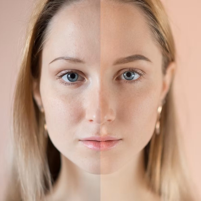 Signature Facial Cupping