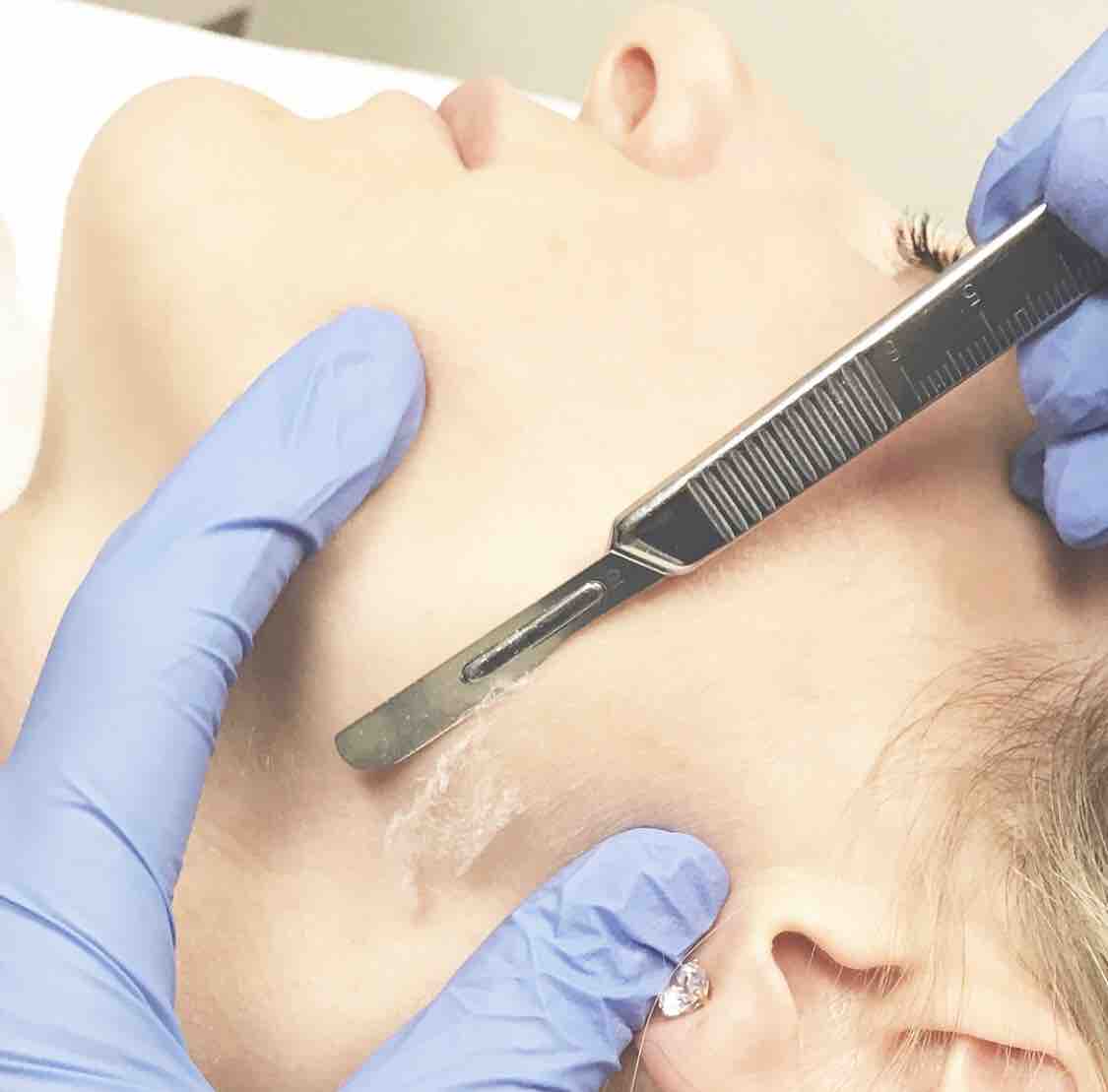Dermafacial