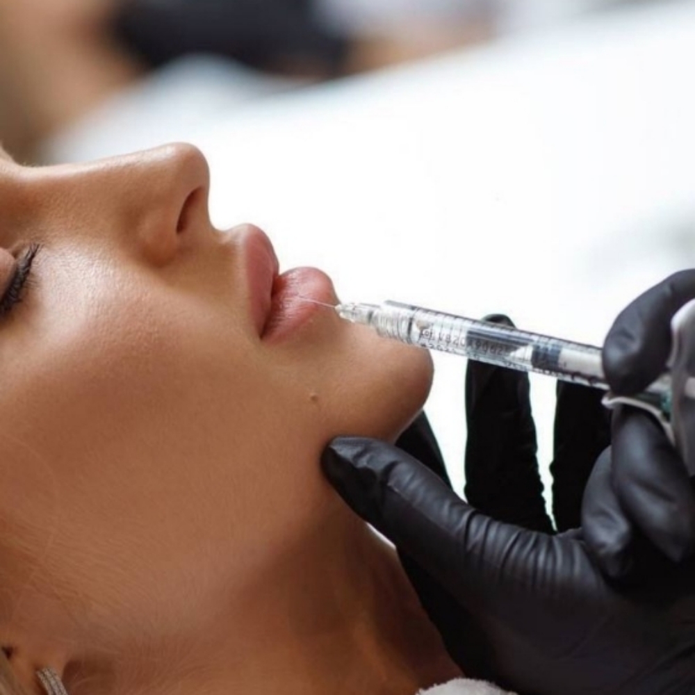 Russian Lips at D'Yalorde Wellness & Aesthetics LLC in El Paso, TX