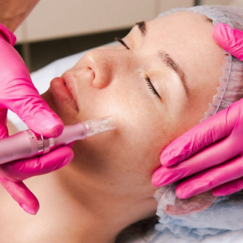 ✨Microneedling + PDRN Salmon DNA ✨ at Nena’s Beauty Glow Bar in North Las Vegas, NV