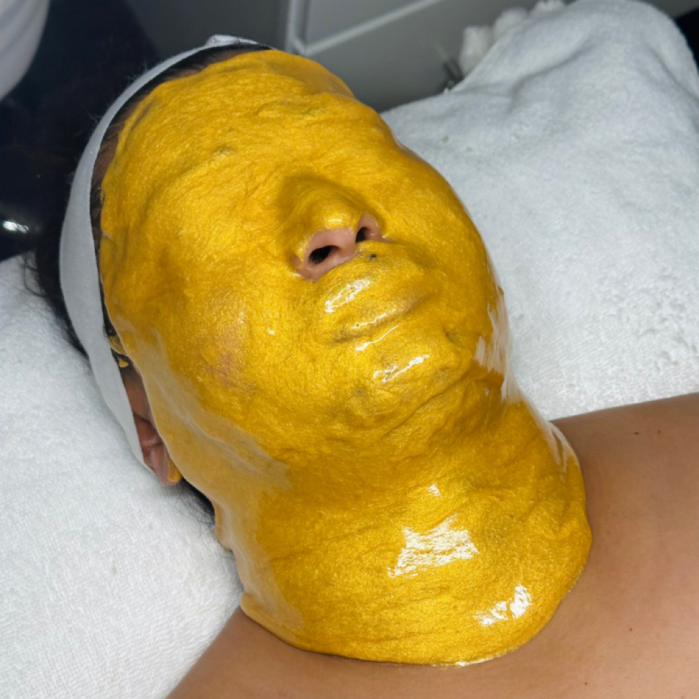 Melasma & Pigment Revision at SORA Skin & Ritual House in Peoria, AZ