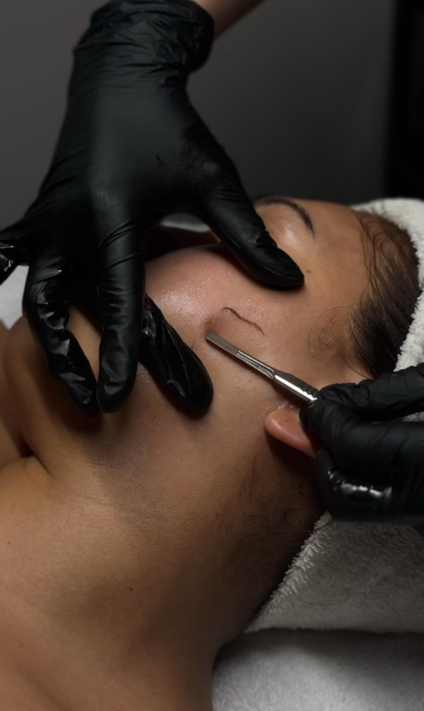 Dermaplane Add-on