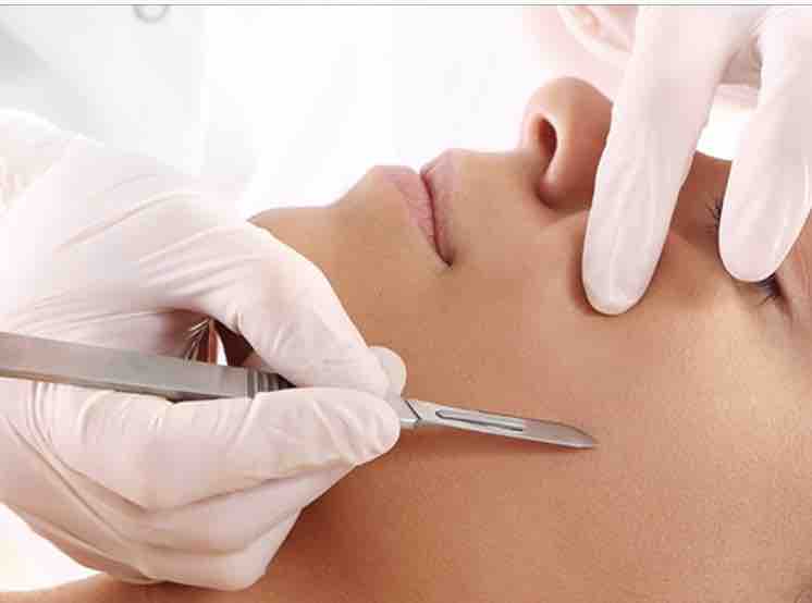 Dermaplane Facial