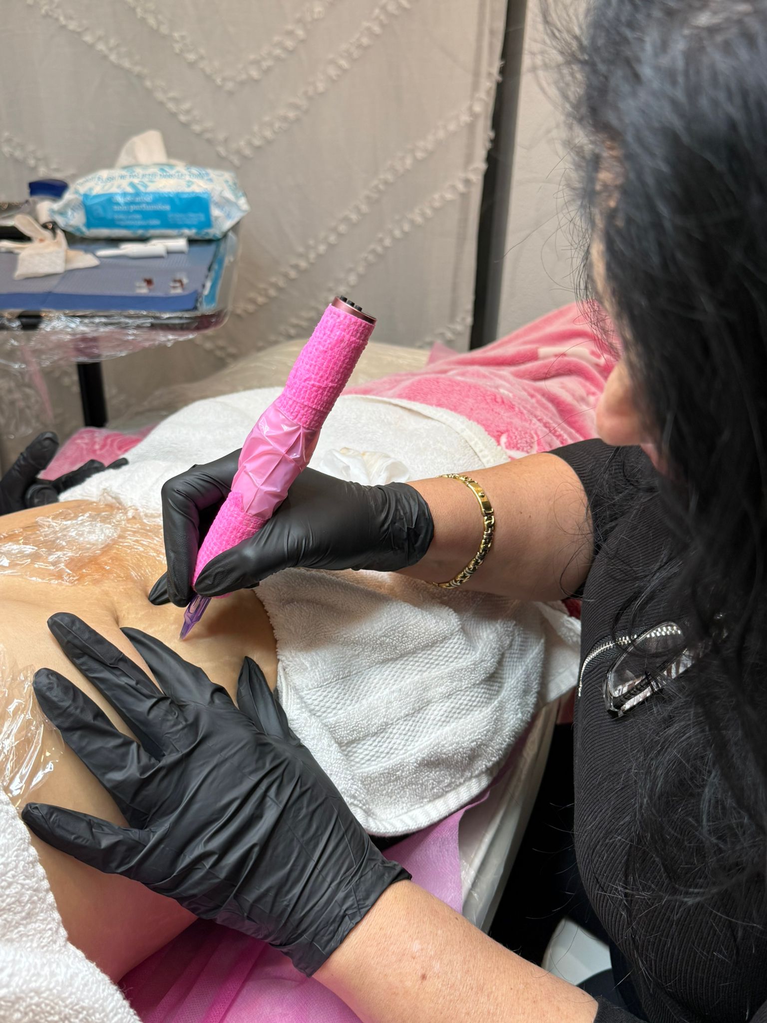 Paramedical Tattoo Skin Camouflage