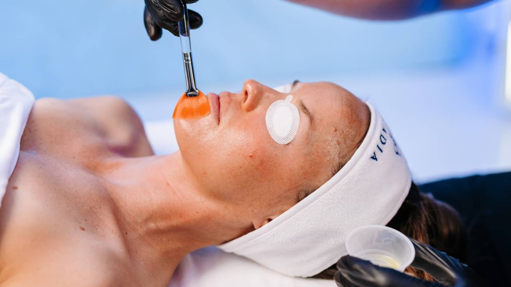 Lactic Acid Peel Add On