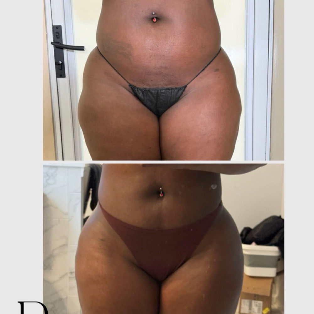 Liquid BBL 400 ML at Pleasures of Beautee in Atlanta, GA